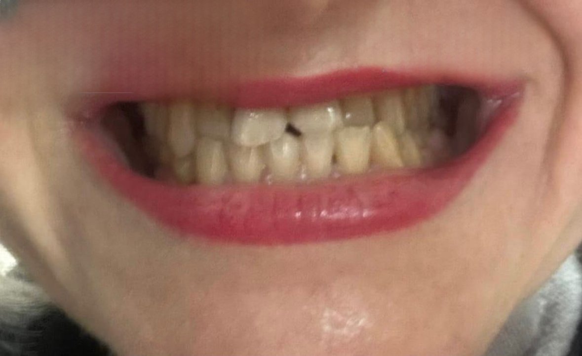 Before